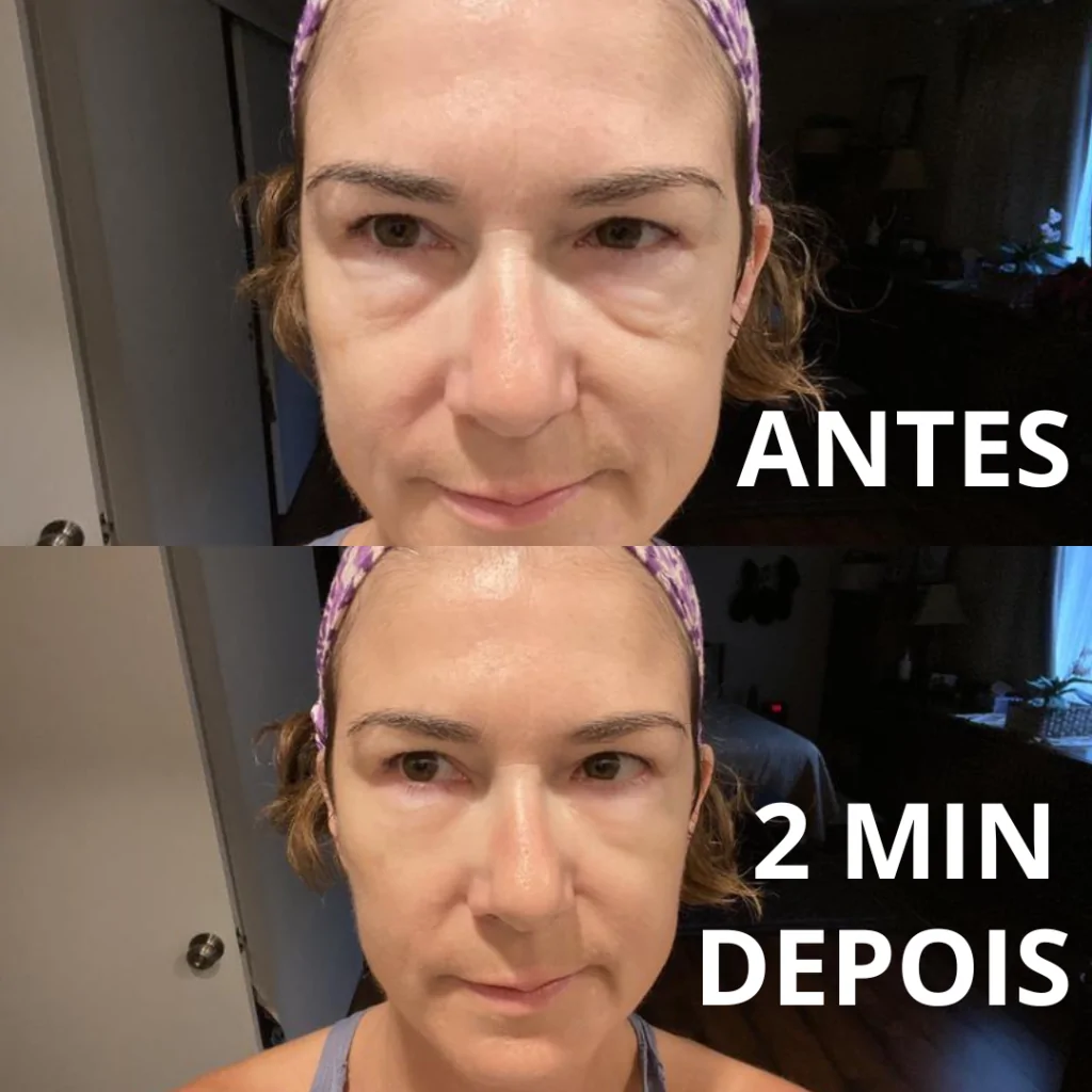 Antes e Depois 2