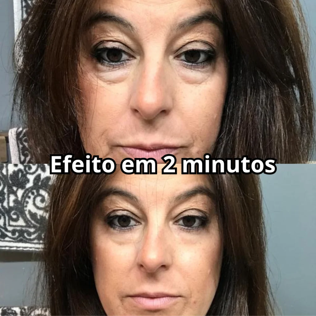 Antes e Depois 1